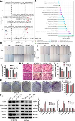 Corrigendum: Comprehensive analysis of the potential immune-related biomarker transporter associated with antigen processing 1 that inhibits metastasis and invasion of ovarian cancer cells